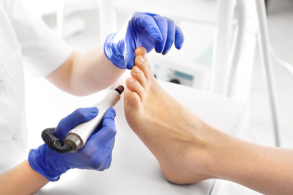 Pedicure. Removal of corns and callus using a milling machine.